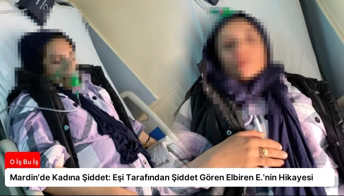 Mardin’de Kadına Şiddet: Eşi Tarafından Şiddet Gören Elbiren E.’nin Hikayesi