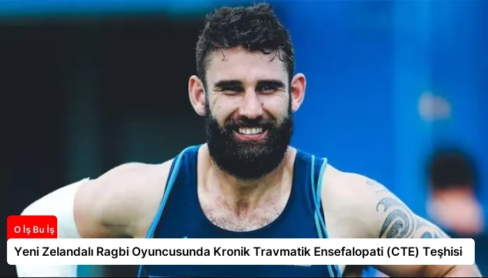 Yeni Zelandalı Ragbi Oyuncusunda Kronik Travmatik Ensefalopati (CTE) Teşhisi