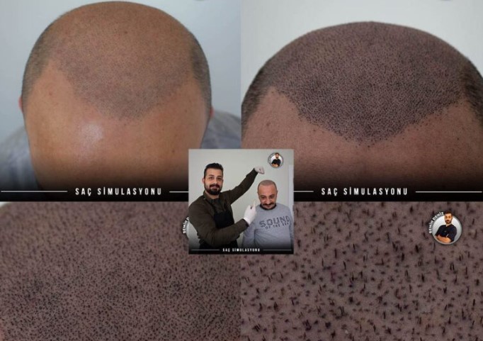 Semih Deniz İle Saç Simülasyonunun Farkını Hissedin