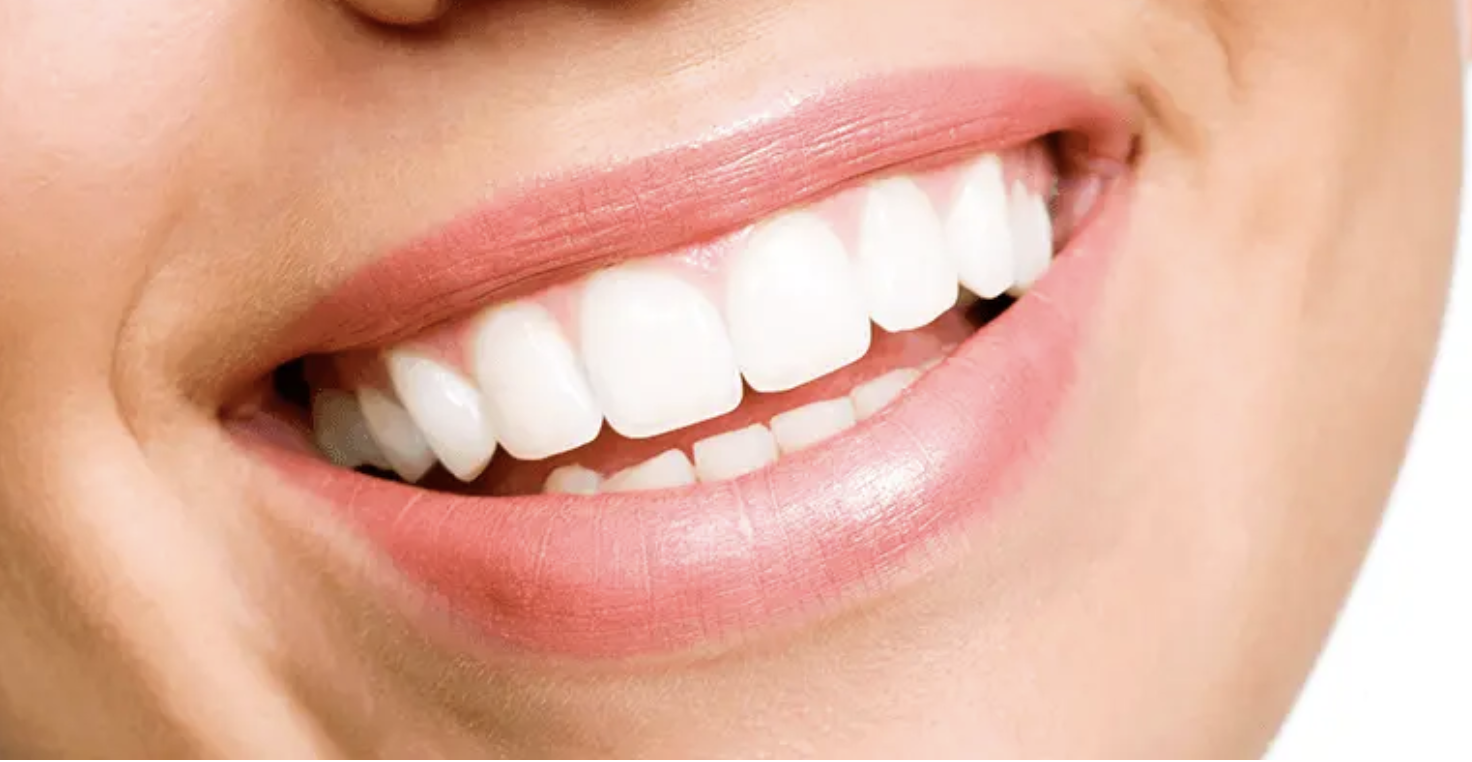 Hollywood Smile Nedir?